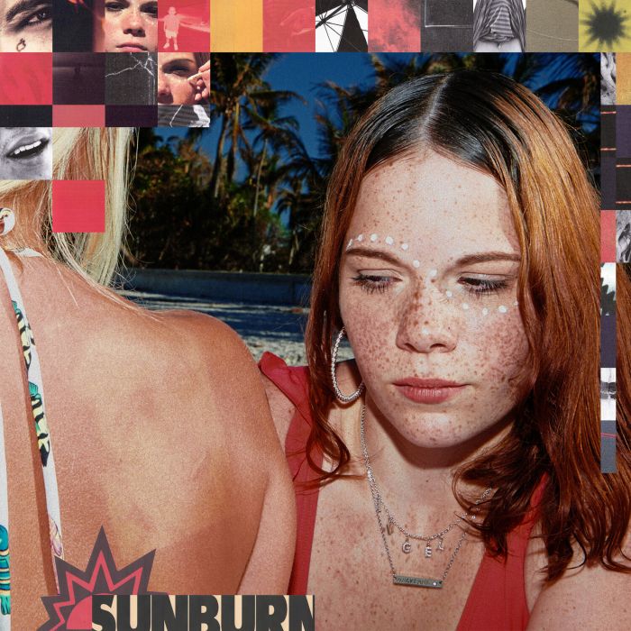 DOMINIC FIKE - SUNBURN