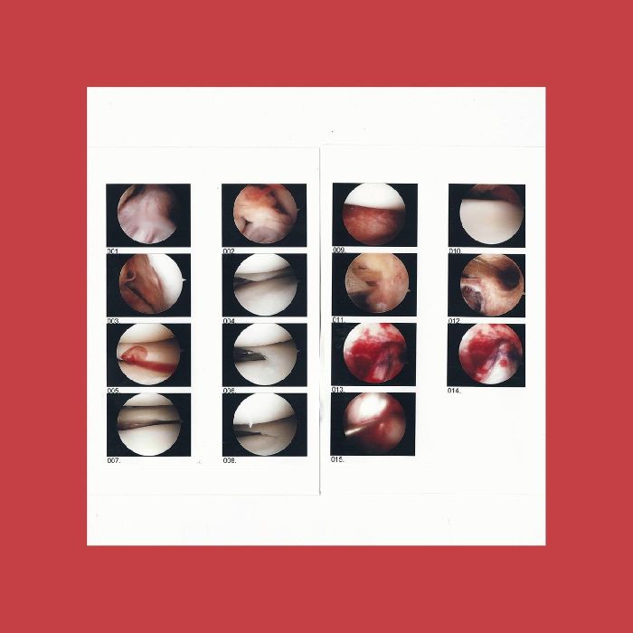 CRADLE - LAUGHING IN MY SLEEP (COKE BOTTLE GREEN VINYL/DL CARD)