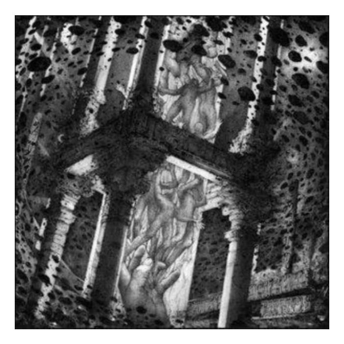 BEDSORE / MORTAL INCARNATION - SPLIT (ULTRA CLEAR VINYL)