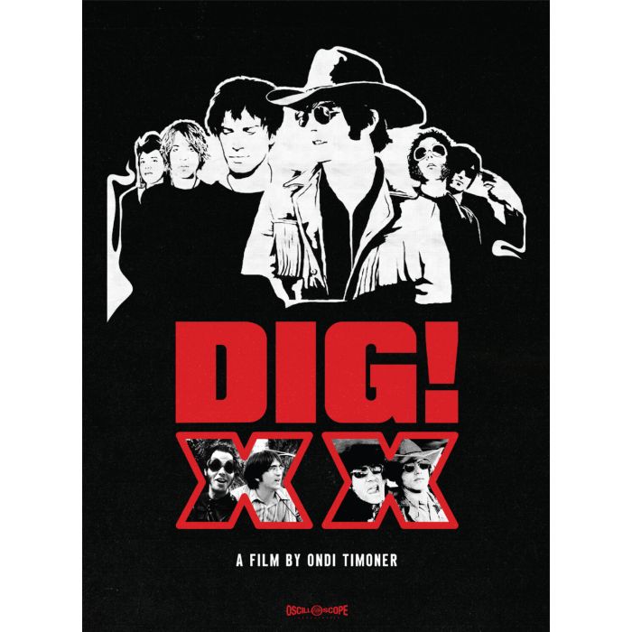 DIG! XX