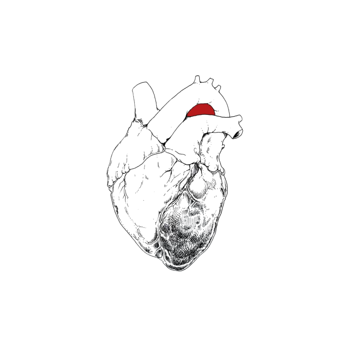 SWANS - BEGGAR