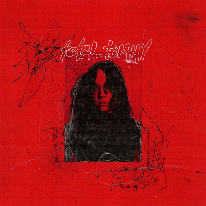 TOTAL TOMMY - BRUISES
