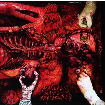 200 STAB WOUNDS - MANUAL MANIC PROCEDURES