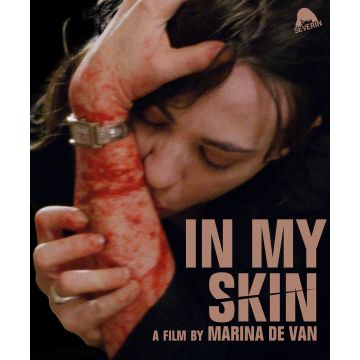IN MY SKIN