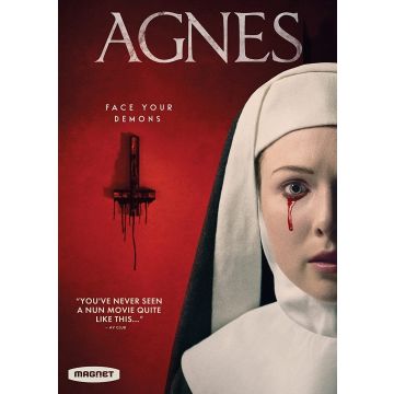 AGNES
